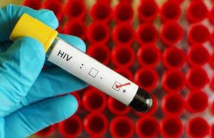 Instan a usar preservativo para prevenir enfermedades de transmisión sexual, entre ellas el HIV
